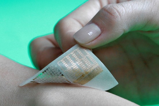 implantes